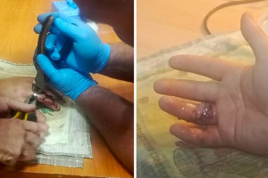 Во Владимире парень едва не оторвал палец при занятиях на турнике