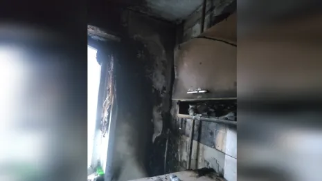 На пожаре в Коврове пострадала 33-летняя женщина