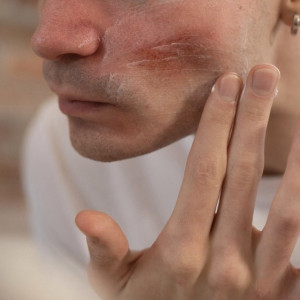 Житель Вязников откусил нос отчиму возлюбленной