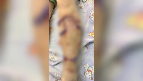 Жители Киржача испугались из-за нападающих на людей и животных собак