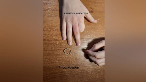 В Коврове у 9-летнего школьника палец застрял в погнутом кольце