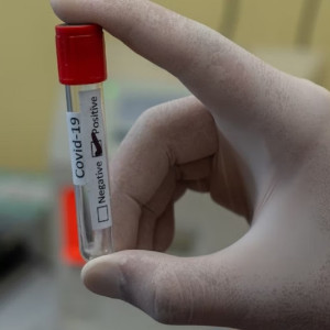 Во Владимирской области эпидемиологи рассказали о 521 новом случае ковида