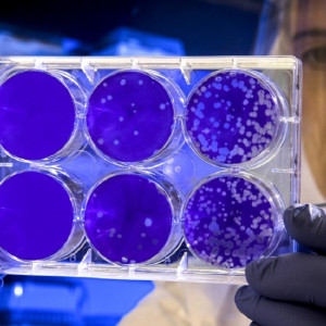 
Во Владимирской области с начала пандемии ковидом заболели 185 тыс. человек