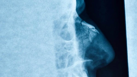 20-летний владимирец сломал полицейскому нос