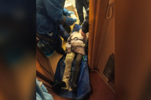 Во Владимире пытавшаяся спуститься по связанным простыням из окна бабушка упала и сломала бедро