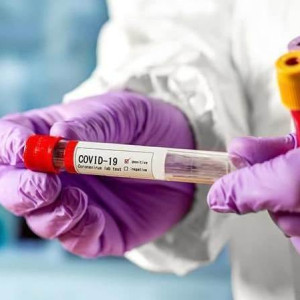 Во Владимирской области за сутки выявили 2047 новых случаев заражений ковидом