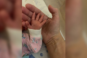 Недоношенного младенца весом 1200 г отправили из Владимира в Москву