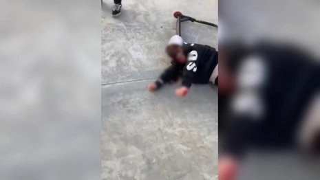 Во владимирском парке Доброселький мальчик разбил голову при падении с самоката