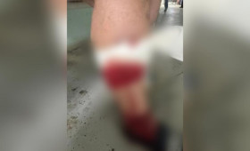 В Коврове собаки напали на 4 взрослых и ребенка