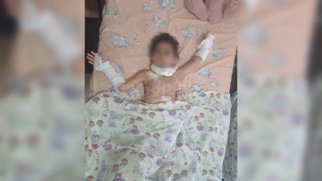Стало известно состояние выпавшей в Коврове из окна 5 этажа девочки