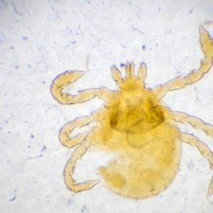 Во Владимирской области впервые за год клещ укусил ребенка