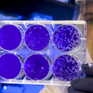 Во Владимирской области заболеваемость ковидом выросла до 33 случаев
