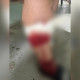 В Коврове собаки напали на 4 взрослых и ребенка