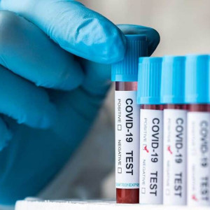 Во Владимирской области зарегистрировали 14 новых случаев заражения ковидом