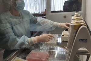 Во Владимирской области с людей сняли 5 зараженных вирусами клещей