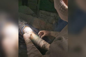 Во Владимире врачи помогли детскому футбольному тренеру вернуться к работе