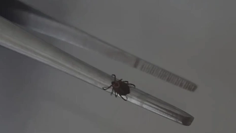 Во Владимирской области с людей сняли 2 зараженных инфекциями клещей