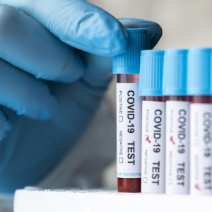 Во Владимирской области санврачи рассказали о 33 новых случаях COVID-19