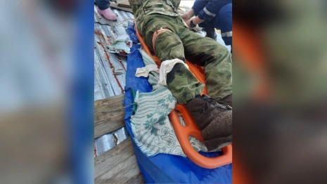 Житель Коврова разрезал ногу болгаркой во время ремонта крыши