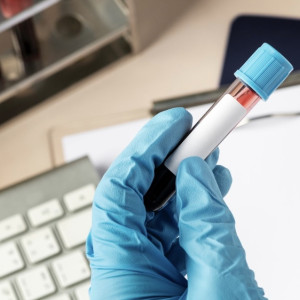 Во Владимирской области у 91 жителя подтвердился ковид