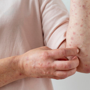 Очаги кори обнаружили в двух районах Владимирской области