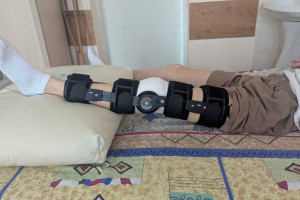 Владимирские врачи провели сложную операцию 15-летнему мальчику с травмой колена