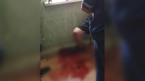 Во Владимире спасли жизнь двоим порезавшим себя мужчинам