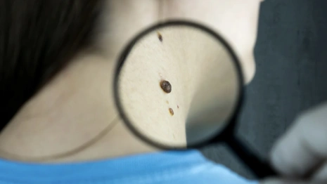 Владимирская область вошла в антирейтинг по заболеваемости раком