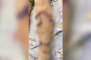 Жители Киржача испугались из-за нападающих на людей и животных собак