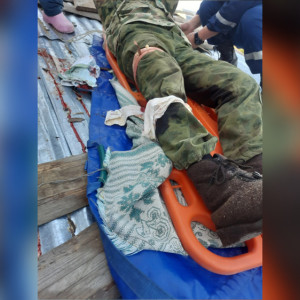 Житель Коврова разрезал ногу болгаркой во время ремонта крыши