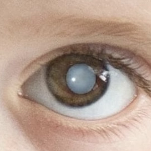 Владимирские врачи спасли ребенка с травмой глаза