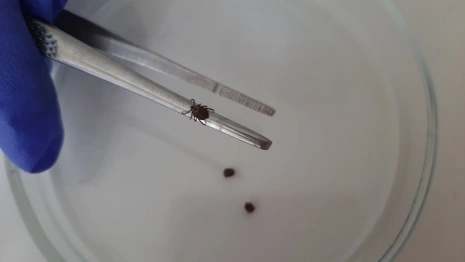 Во Владимирской области сняли клещей с 17 детей