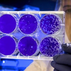 Во Владимирской области санврачи рассказали о 86 случаях ковида