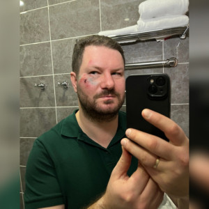 Сбитый в Суздале гужевой повозкой московский журналист записал видео