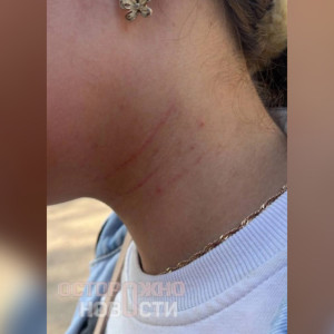 В Сети появились слухи об избиении детей группой подростков в Карабаново