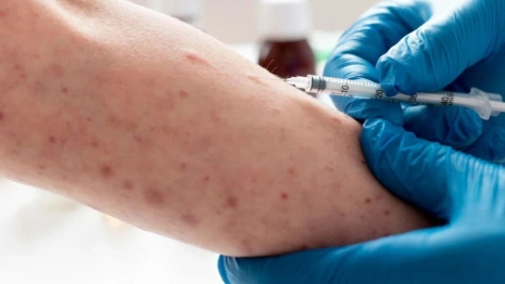 Корь добралась до третьего района Владимирской области
