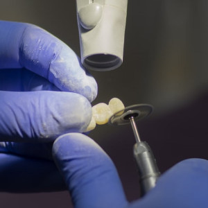 Во Владимирской области цены на стоматологию могут вырасти к Новому году
