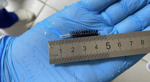 Владимирские врачи спасли поглотившего кончик ершика мужчину