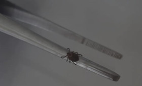 Во Владимирской области с людей сняли 2 зараженных инфекциями клещей