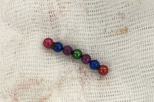 Во Владимире врачи спасли проглотившего магнитные шарики 4-летнего малыша