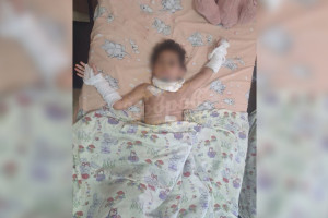 Стало известно состояние выпавшей в Коврове из окна 5 этажа девочки