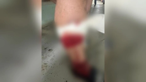 В Коврове собаки напали на 4 взрослых и ребенка