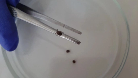 Во Владимирской области за неделю клещи укусили 30 взрослых и 9 детей