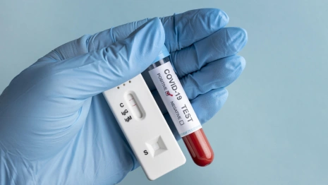 Во Владимирской область заболеваемость ковидом выросла до 65 случаев