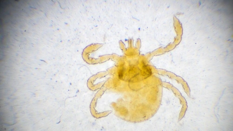 Во Владимирской области впервые за год клещ укусил ребенка
