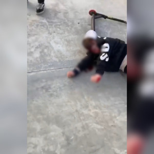 Во владимирском парке Доброселький мальчик разбил голову при падении с самоката