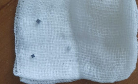 Владимирские врачи спасли проглотившего магниты годовалого малыша