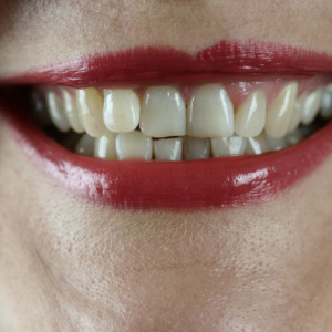 Во Владимирской области девушку оштрафовали за укус полицейского