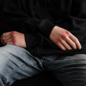 «Над ним уже издевались в классе». Что известно о избитом школьнике из Юрьев-Польского