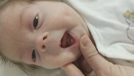 Во Владимире родился младенец с зубами